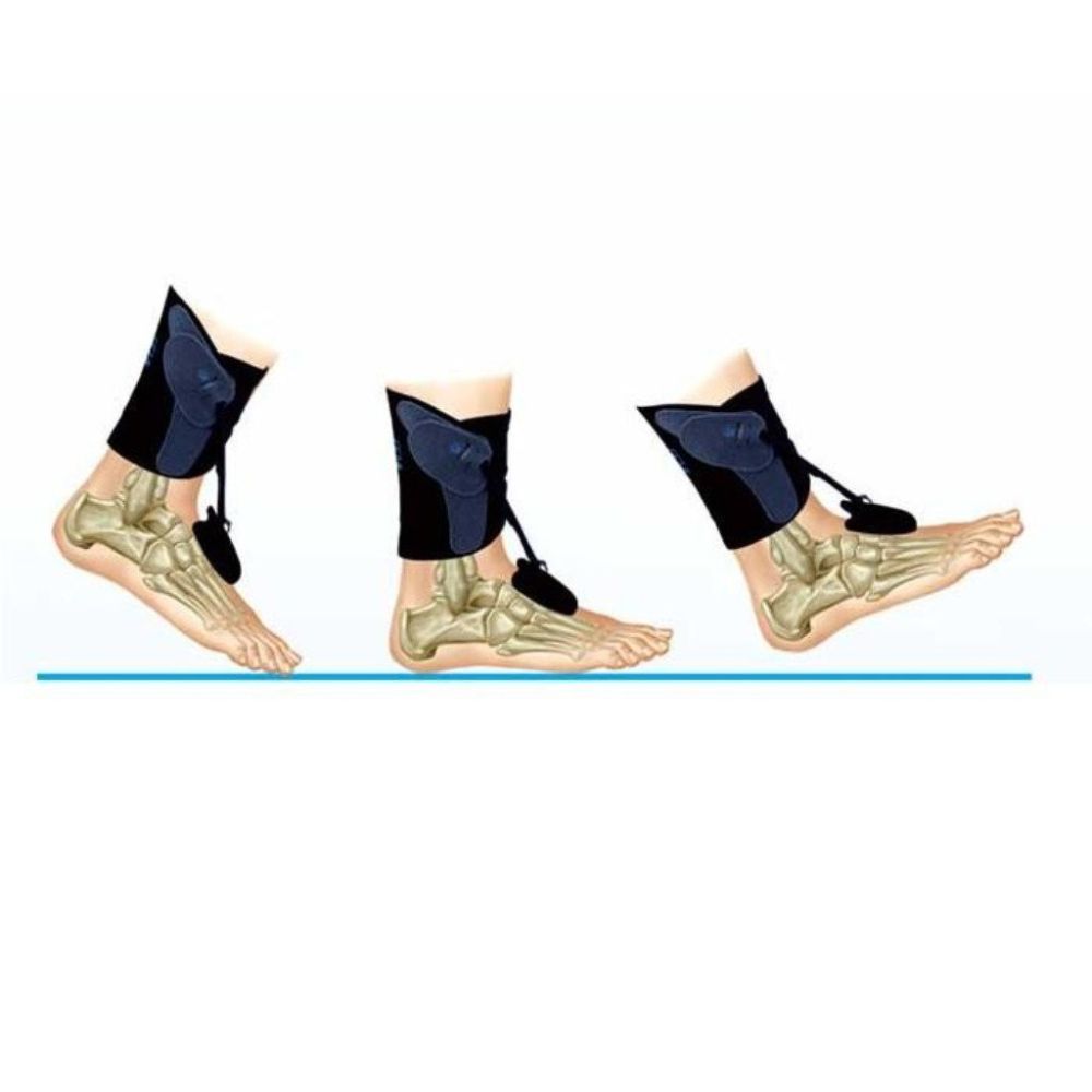 Ортоза за спуштено стапало