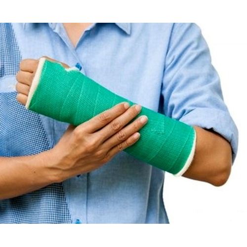 Пластичен гипс