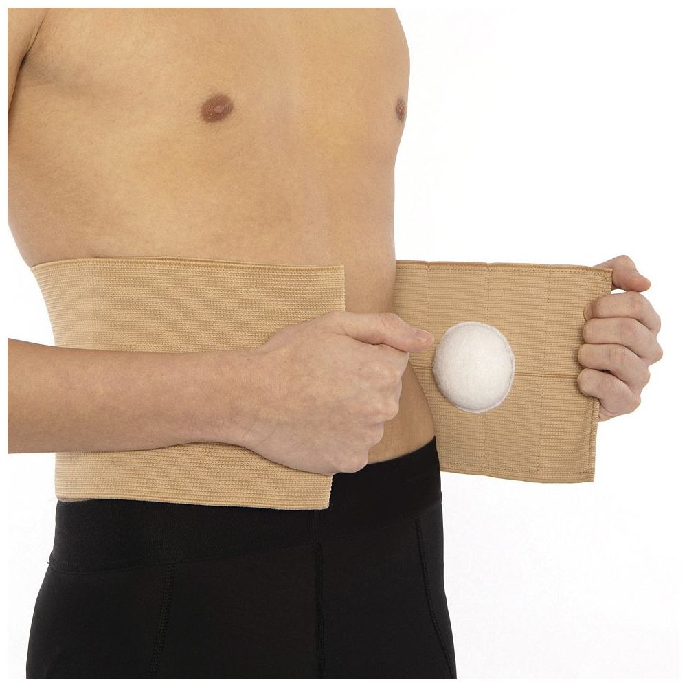 Појас за папочна кила