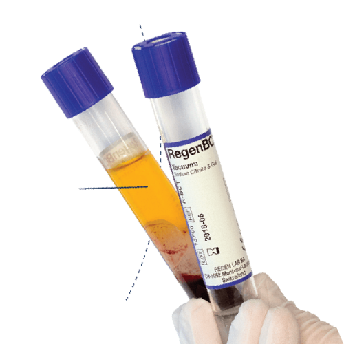 Regen Lab BCT епрувета за подготовка на ПРП RegenKit® BCT
