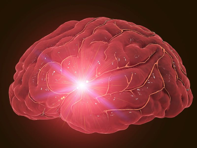 Како да се справите со последиците од мозочен удар?