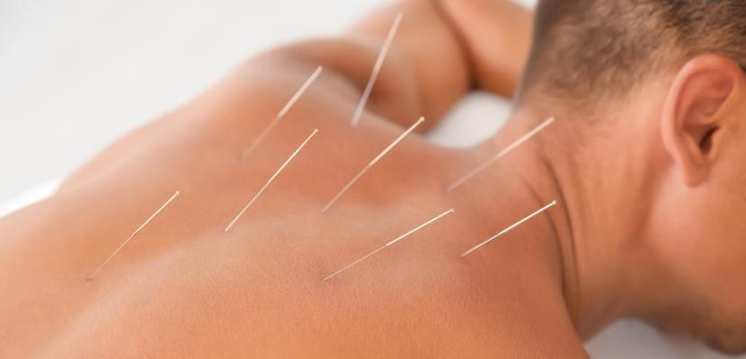 Спец. физиотерапевт Блаже Арсов не запознава што значи Dry needling терапија и за што се употребува