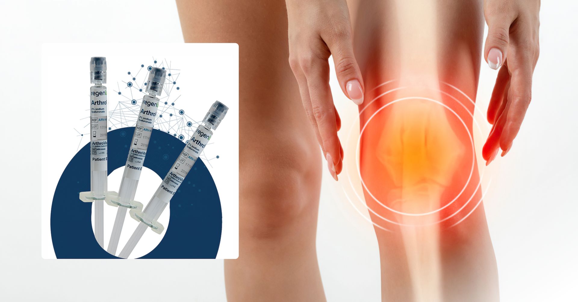 Што е ArthroVisc®40 и како делува ?