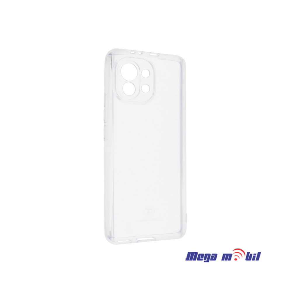Futrola Xiaomi Mi 11 Lite 5G Pudding transparent